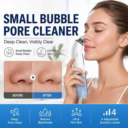 3-in-1 Aqua Facial Vacuum – Deep Pore Cleaner & Blackhead Remover